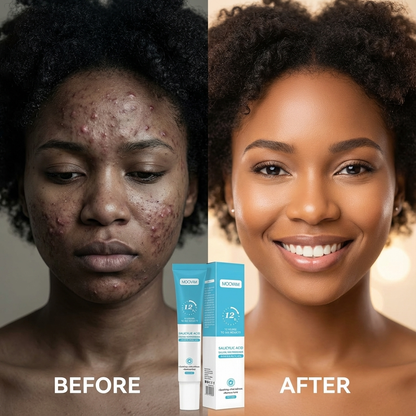 🌿 Gel Anti-taches & Anti-acné Mooyam - Acide salicylique & Salvia Miltiorrzha